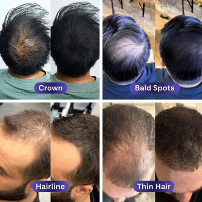 Confeo for Men – No One Notices the Difference